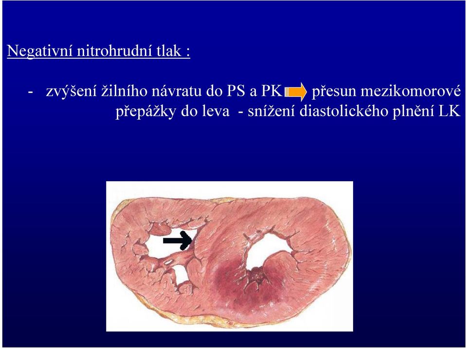 návratu do PS a PK přesun mezikomorové