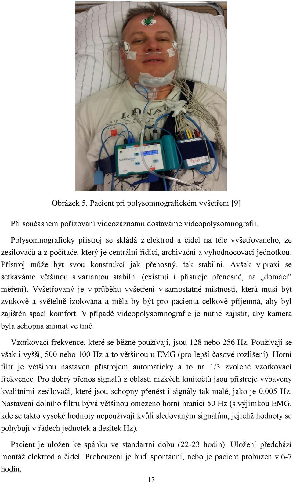 Přístroj může být svou konstrukcí jak přenosný, tak stabilní. Avšak v praxi se setkáváme většinou s variantou stabilní (existují i přístroje přenosné, na domácí měření).