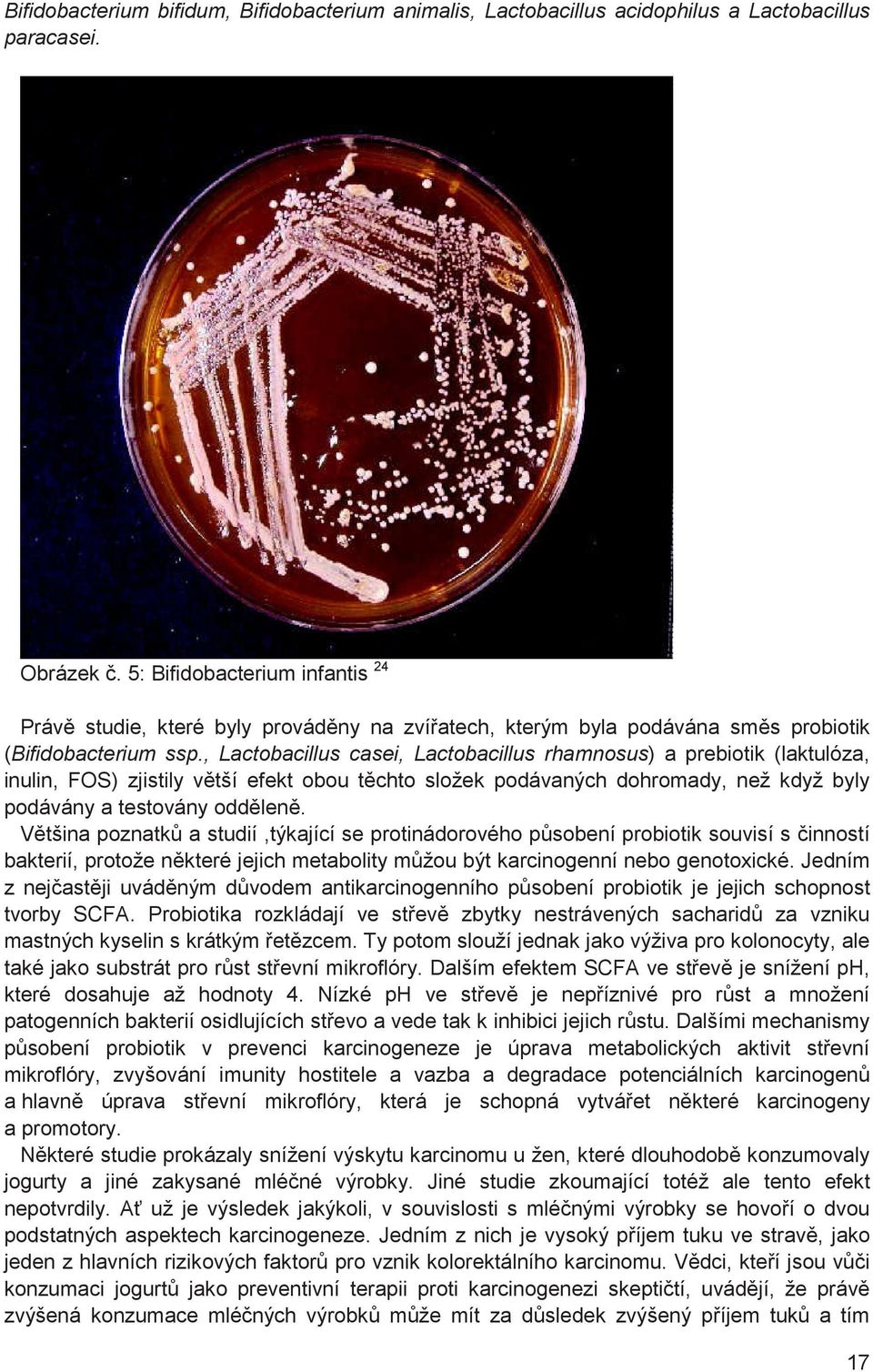 , Lactobacillus casei, Lactobacillus rhamnosus) a prebiotik (laktulóza, inulin, FOS) zjistily v tší efekt obou t chto složek podávaných dohromady, než když byly podávány a testovány odd len.