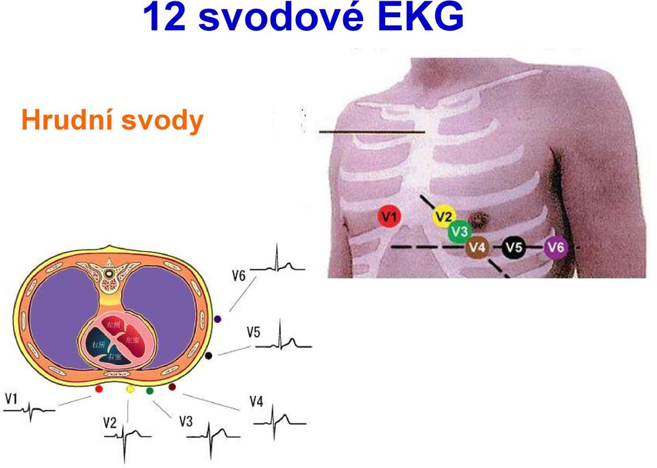 svodové