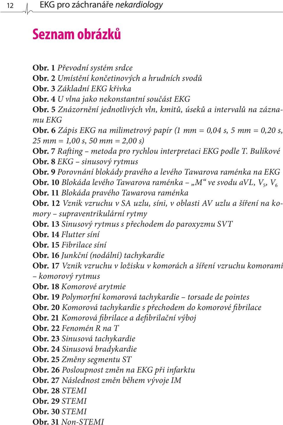 6 Zápis EKG na milimetrový papír (1 mm = 0,04 s, 5 mm = 0,20 s, 25 mm = 1,00 s, 50 mm = 2,00 s) Obr. 7 Rafting metoda pro rychlou interpretaci EKG podle T. Bulíkové Obr. 8 EKG sinusový rytmus Obr.
