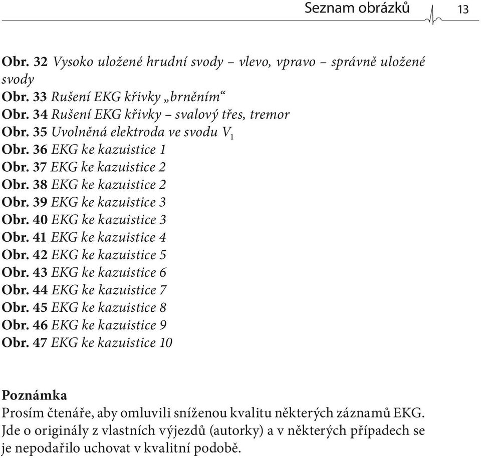 41 EKG ke kazuistice 4 Obr. 42 EKG ke kazuistice 5 Obr. 43 EKG ke kazuistice 6 Obr. 44 EKG ke kazuistice 7 Obr. 45 EKG ke kazuistice 8 Obr. 46 EKG ke kazuistice 9 Obr.