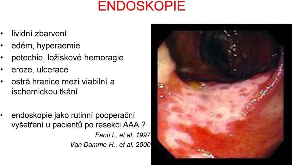 ischemickou tkání endoskopie jako rutinní pooperační vyšetření u
