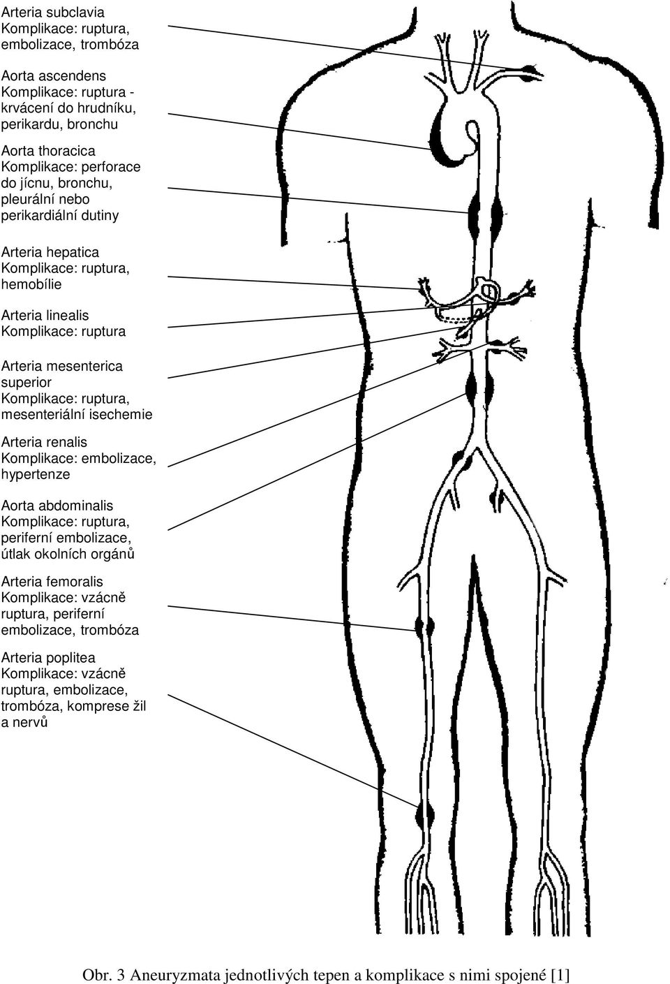 mesenteriální isechemie Arteria renalis Komplikace: embolizace, hypertenze Aorta abdominalis Komplikace: ruptura, periferní embolizace, útlak okolních orgánů Arteria femoralis Komplikace: