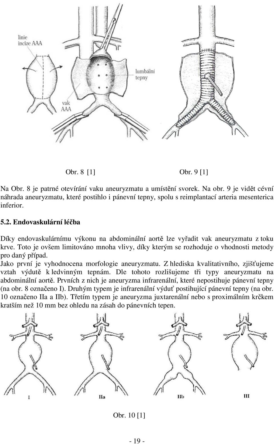 Endovaskulární léčba Díky endovaskulárnímu výkonu na abdominální aortě lze vyřadit vak aneuryzmatu z toku krve.