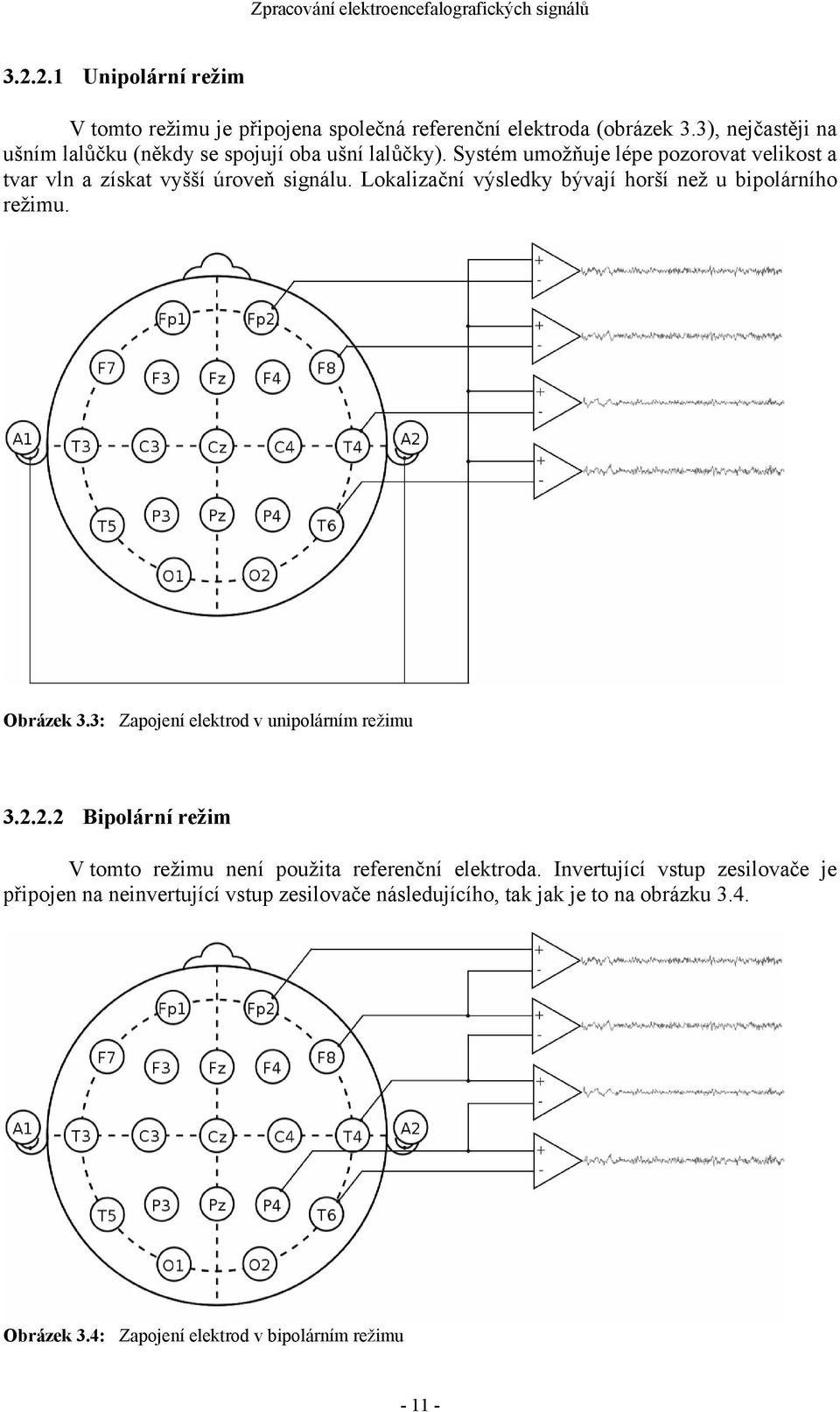 Lokalizační výsledky bývají horší než u bipolárního režimu. Obrázek 3.3: Zapojení elektrod v unipolárním režimu 3.2.