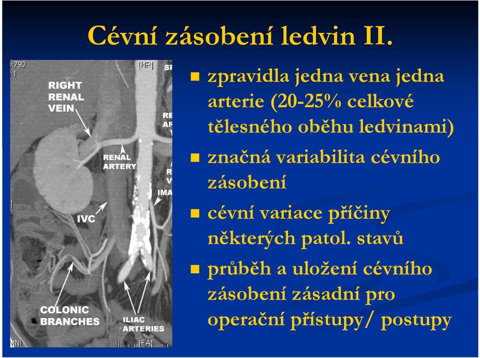 oběhu ledvinami) značná variabilita cévního zásobení cévní