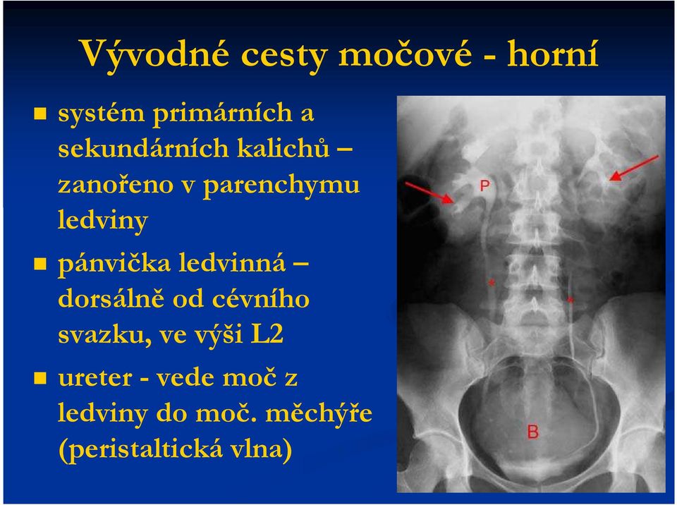 pánvička ledvinná dorsálně od cévního svazku, ve výši