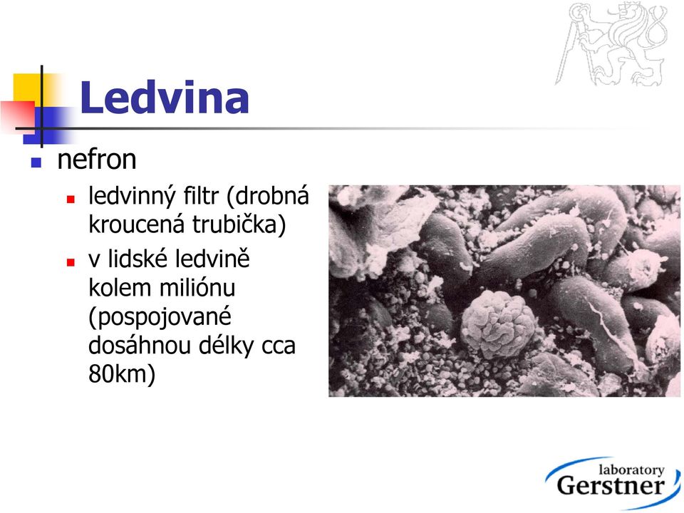 lidské ledvině kolem miliónu