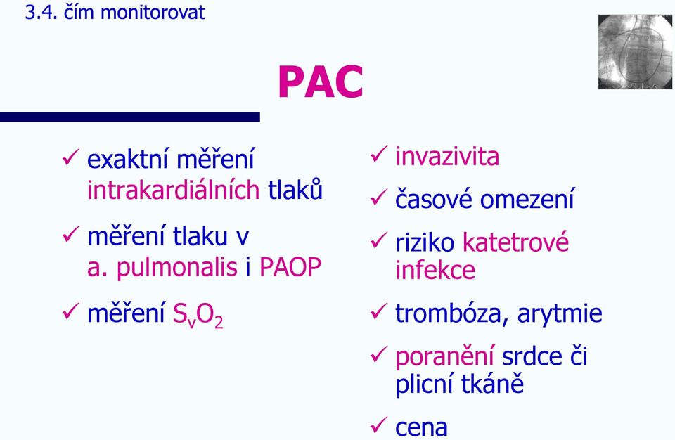 pulmonalis i PAOP měření S v O 2 invazivita časové