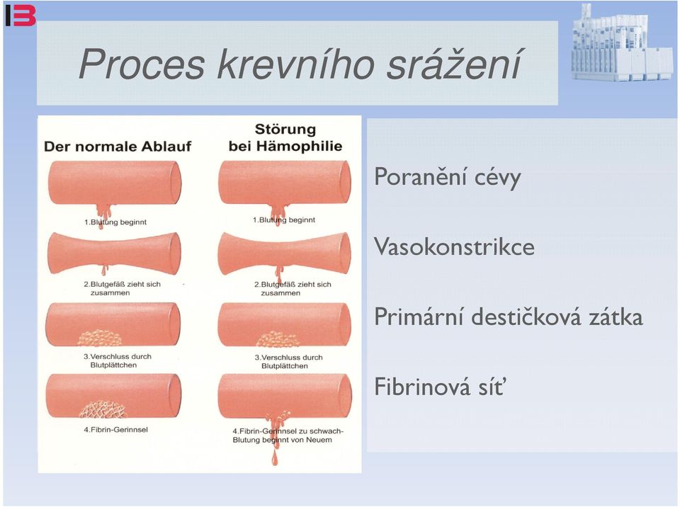 1 Poranění cévy