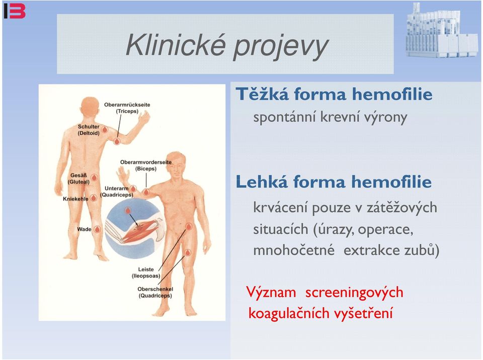 zátěžových situacích (úrazy, operace, mnohočetné