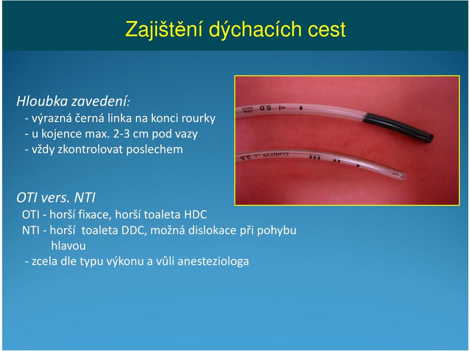 2-3 cm pod vazy - vždy zkontrolovat poslechem OTI vers.