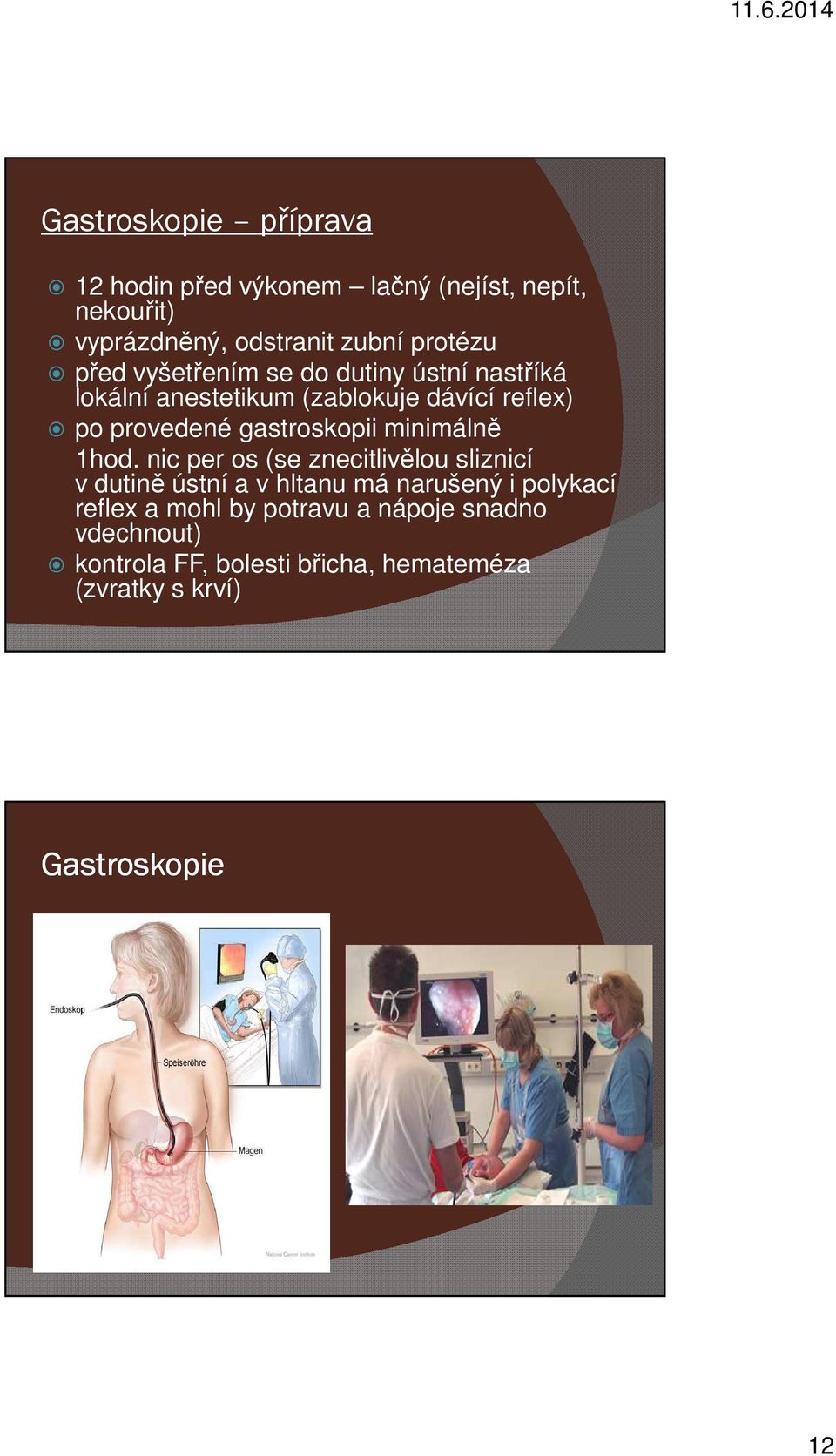 gastroskopii minimálně 1hod.