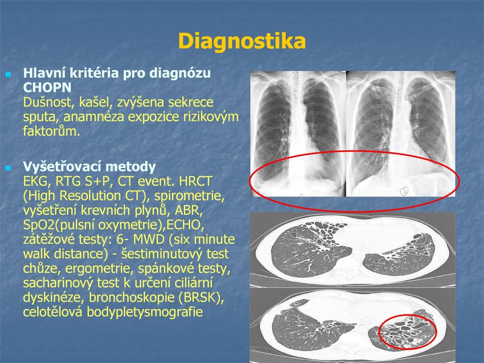 HRCT (High Resolution CT), spirometrie, vyšetření krevních plynů, ABR, SpO2(pulsnípulsní oxymetrie),echo, zátěžové