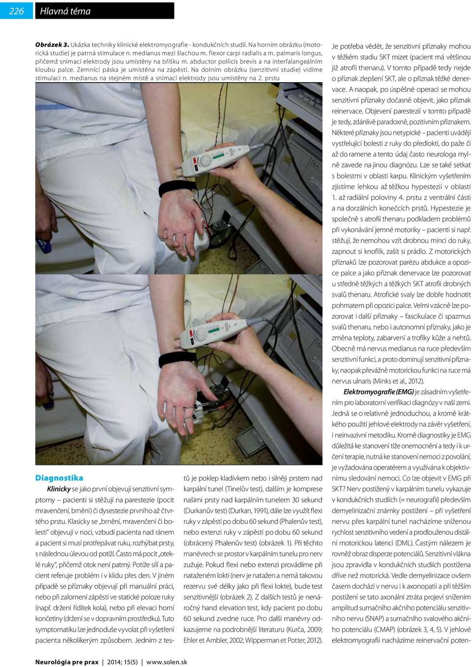 Na dolním obrázku (senzitivní studie) vidíme stimulaci n. medianus na stejném místě a snímací elektrody jsou umístěny na 2.