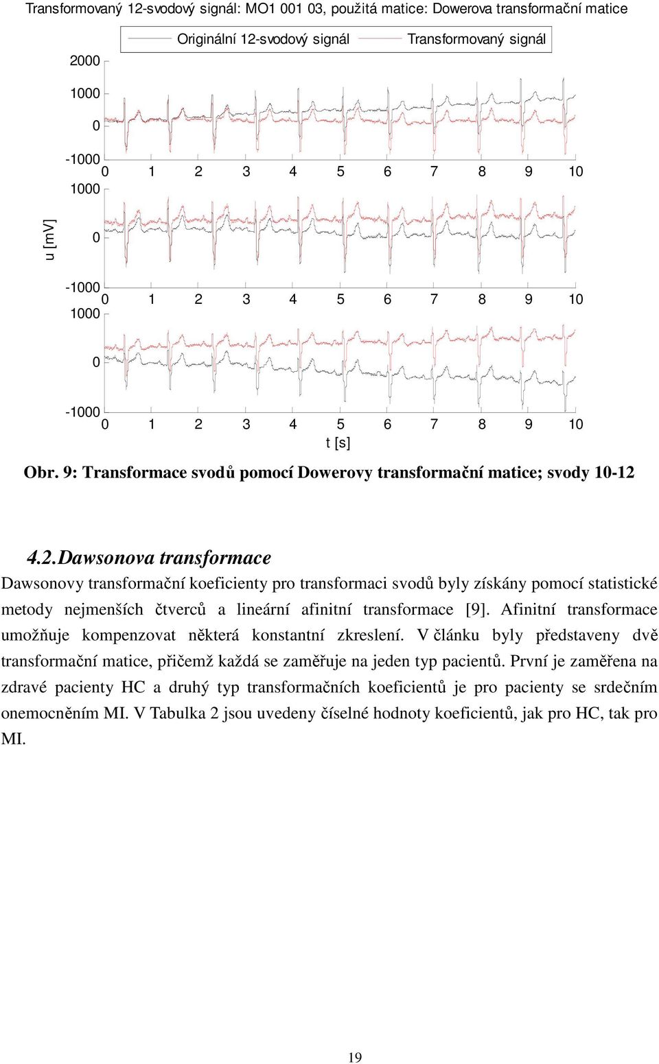 Afinitní transformace umožňuje kompenzovat některá konstantní zkreslení. V článku byly představeny dvě transformační matice, přičemž každá se zaměřuje na jeden typ pacientů.