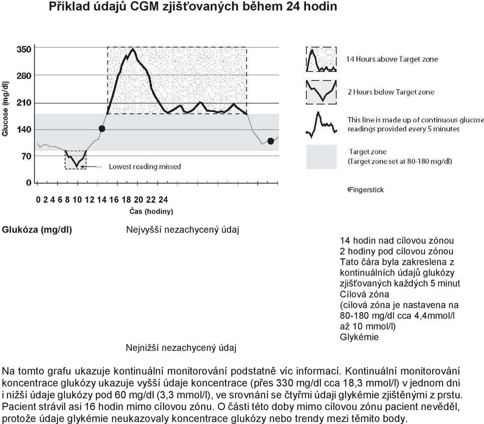 Glykémie Na tomto grafu ukazuje kontinuální monitorování podstatně víc informací.