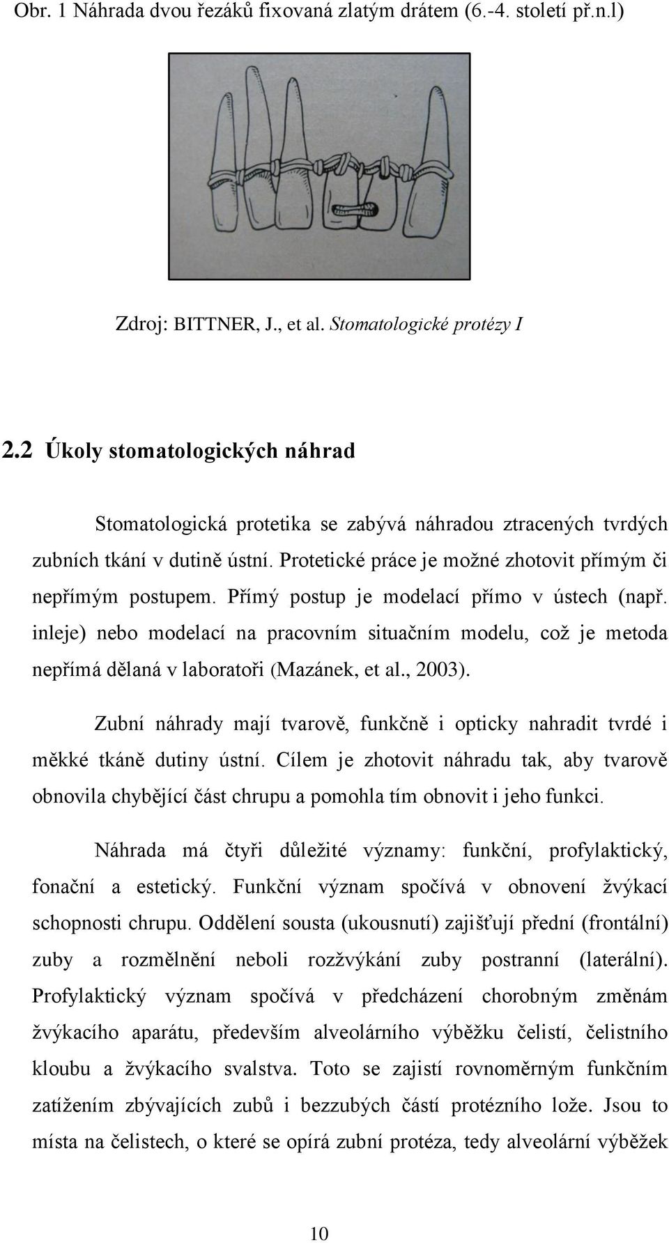 Přímý postup je modelací přímo v ústech (např. inleje) nebo modelací na pracovním situačním modelu, coţ je metoda nepřímá dělaná v laboratoři (Mazánek, et al., 2003).