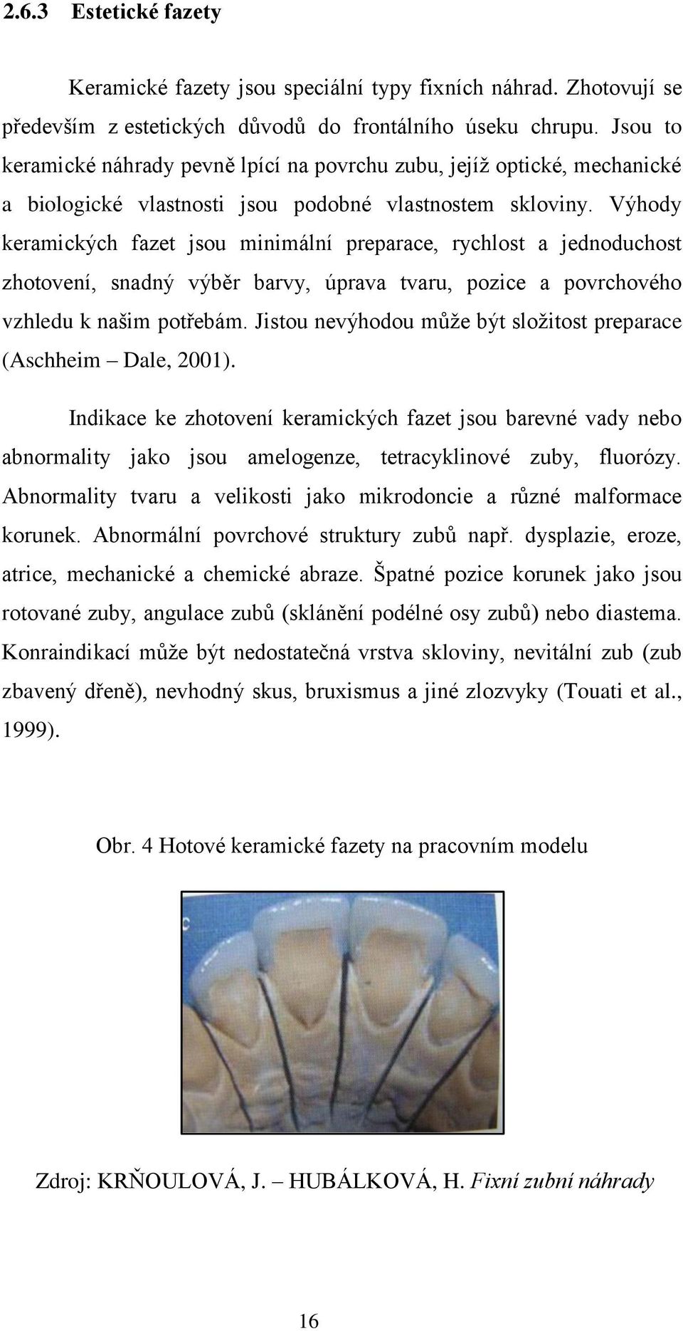 Výhody keramických fazet jsou minimální preparace, rychlost a jednoduchost zhotovení, snadný výběr barvy, úprava tvaru, pozice a povrchového vzhledu k našim potřebám.