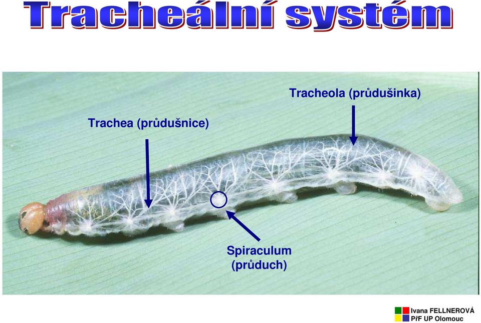 Trachea