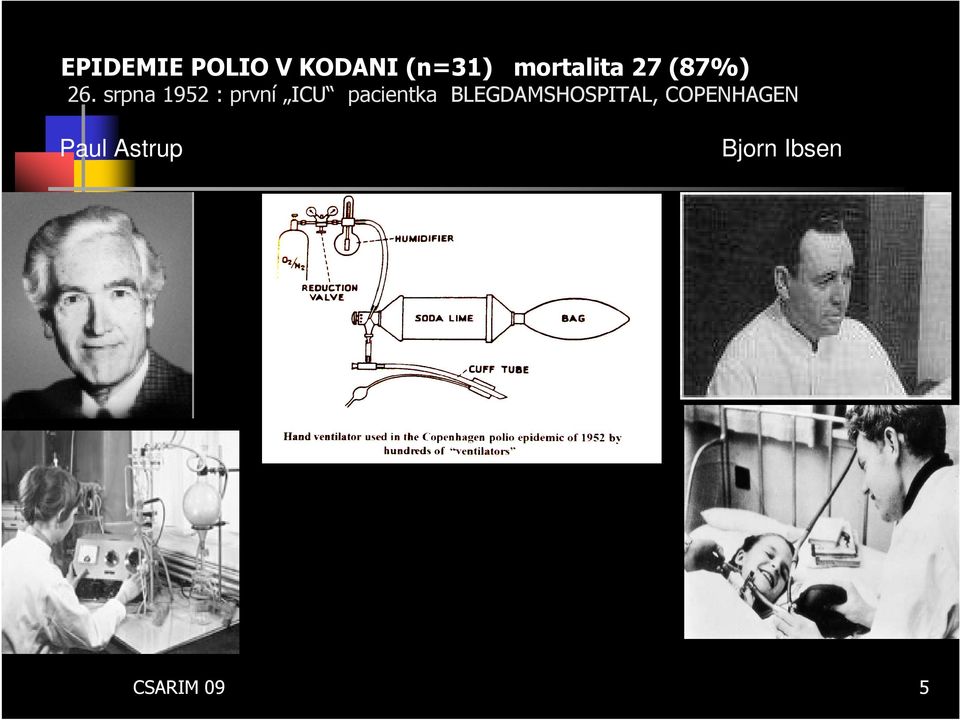 srpna 1952 : první ICU pacientka