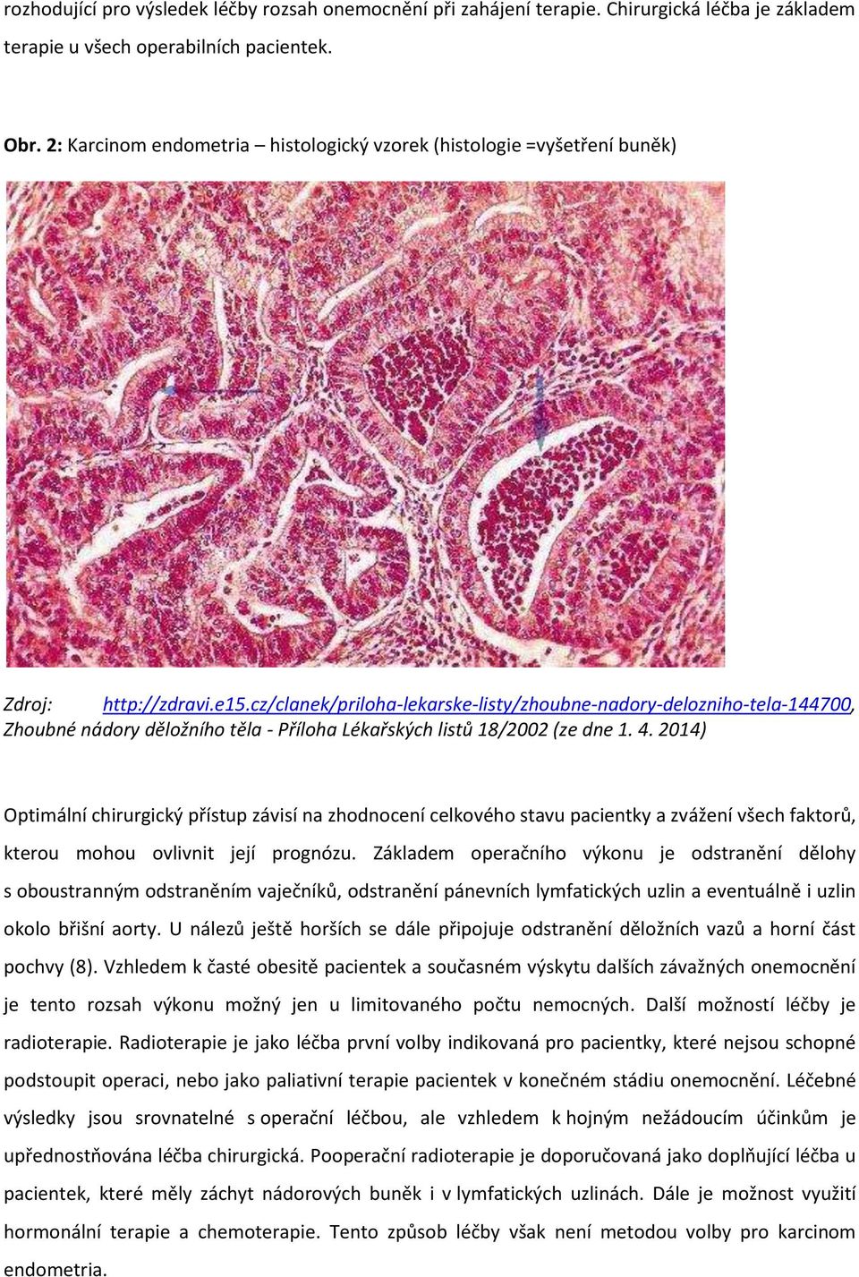 cz/clanek/priloha-lekarske-listy/zhoubne-nadory-delozniho-tela-144700, Zhoubné nádory děložního těla - Příloha Lékařských listů 18/2002 (ze dne 1. 4.