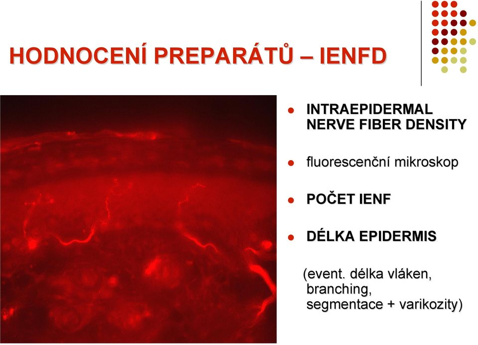 mikroskop POČET IENF DÉLKA EPIDERMIS