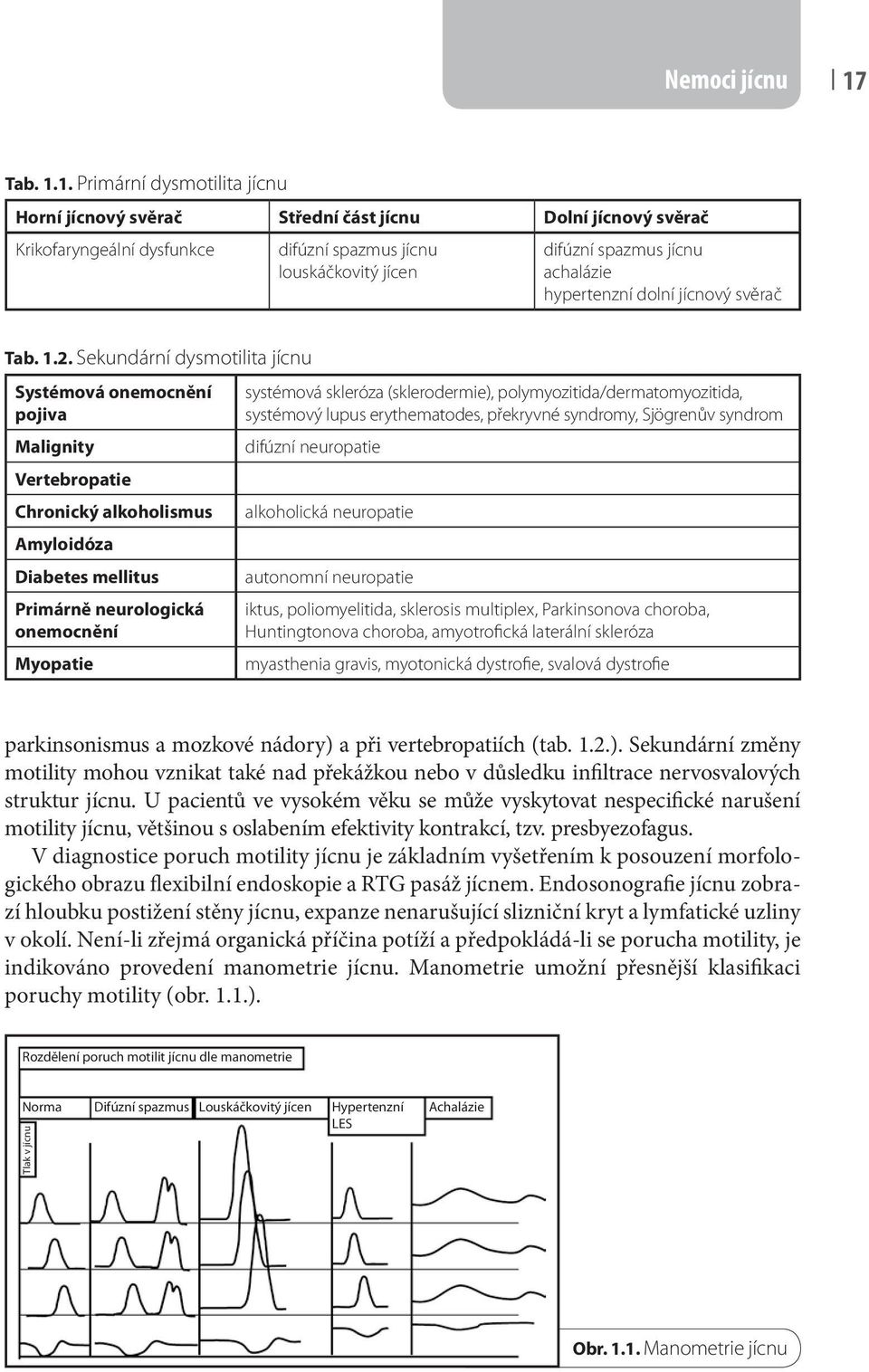 1. Primární dysmotilita jícnu Horní jícnový svěrač Střední část jícnu Dolní jícnový svěrač Krikofaryngeální dysfunkce difúzní spazmus jícnu louskáčkovitý jícen difúzní spazmus jícnu achalázie