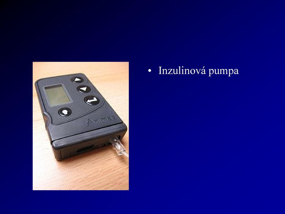 inzulinová pumpa