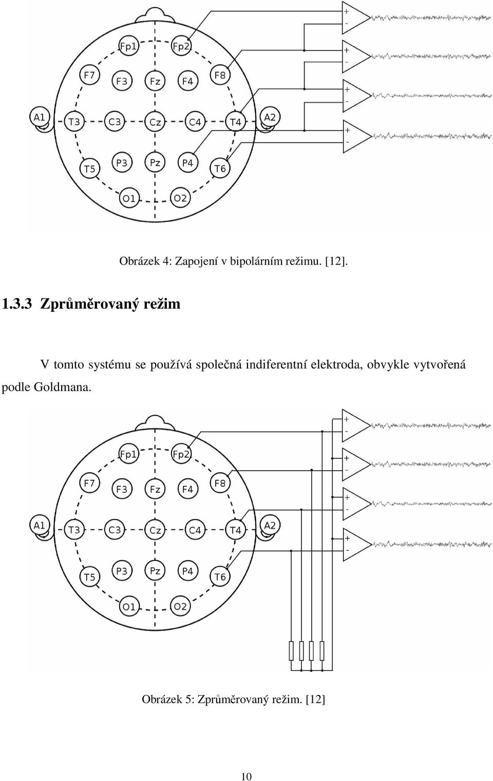 společná indiferentní elektroda, obvykle vytvořená