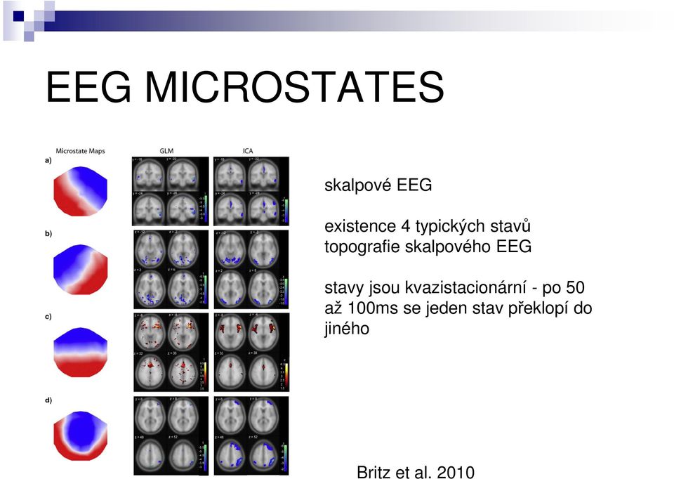 stavy jsou kvazistacionární - po 50 až 100ms