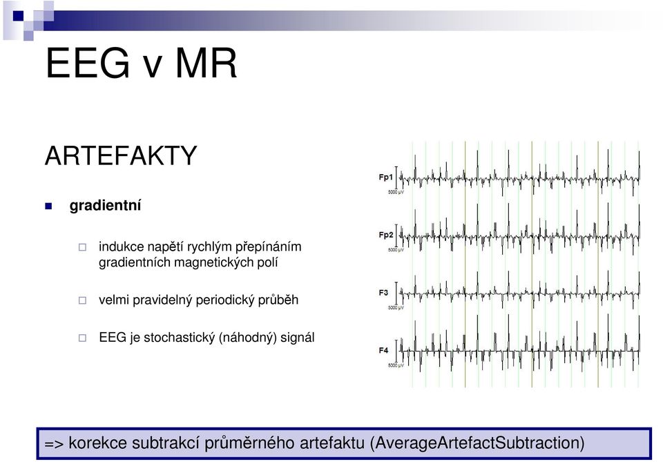 periodický průběh EEG je stochastický (náhodný) signál =>