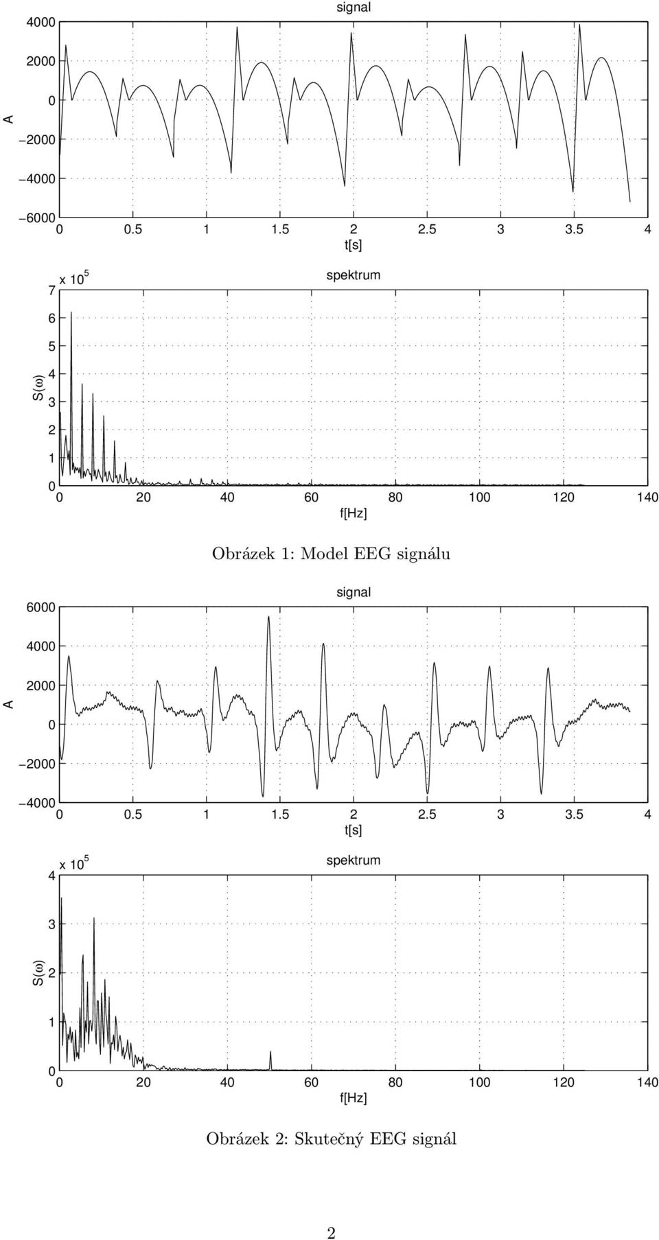 Obrázek 1: Model EEG signálu 6 signal 4 2 A 2 4.5 1 1.5 2 2.