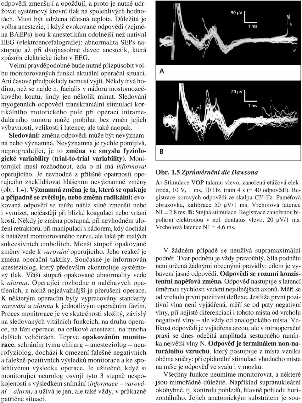 anestetik, která způsobí elektrické ticho v EEG. Velmi pravděpodobně bude nutné přizpůsobit volbu monitorovaných funkcí aktuální operační situaci. Ani časové předpoklady nemusí vyjít.