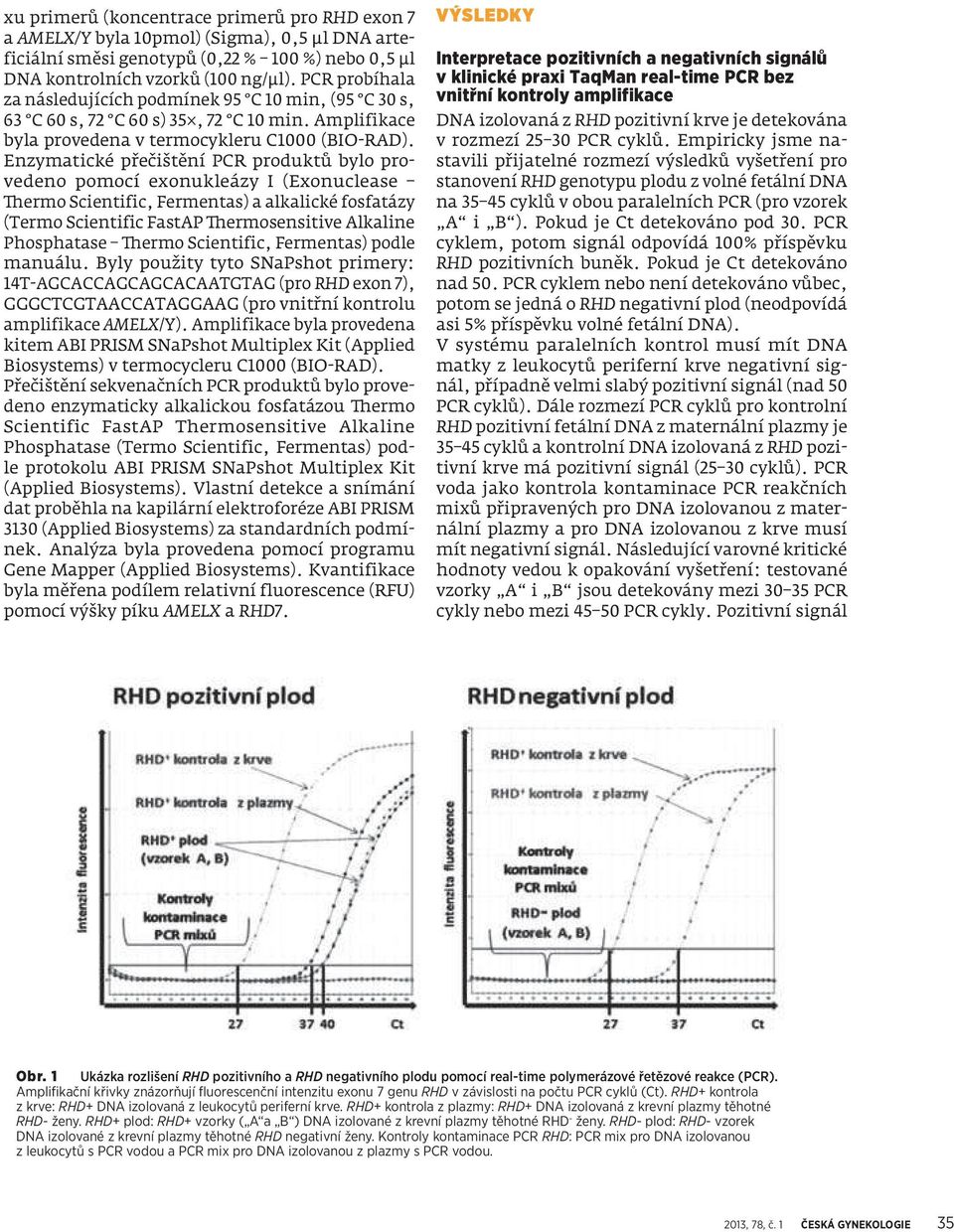 Enzymatické přečištění PCR produktů bylo provedeno pomocí exonukleázy I (Exonuclease Thermo Scientific, Fermentas) a alkalické fosfatázy (Termo Scientific FastAP Thermosensitive Alkaline Phosphatase