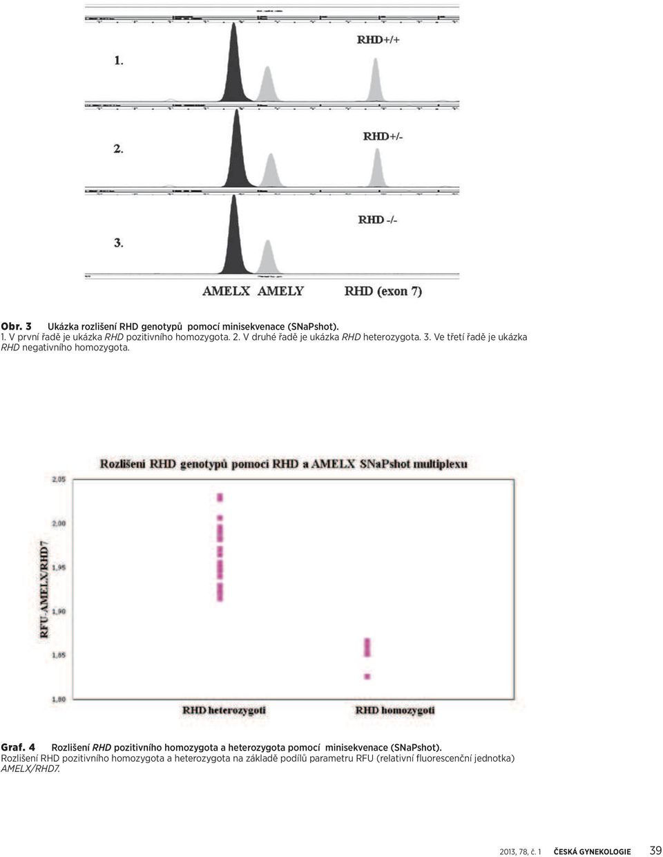 Ve třetí řadě je ukázka RHD negativního homozygota. Graf.