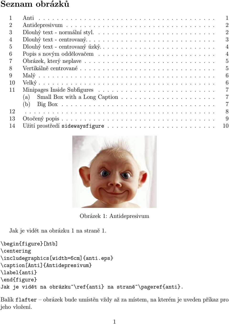 .. 7 (b) BigBox..... 7 12............. 8 13 Otočenýpopis..... 9 14 Užitíprostředísidewaysfigure...... 10 Jakjevidětnaobrázku1nastraně1.