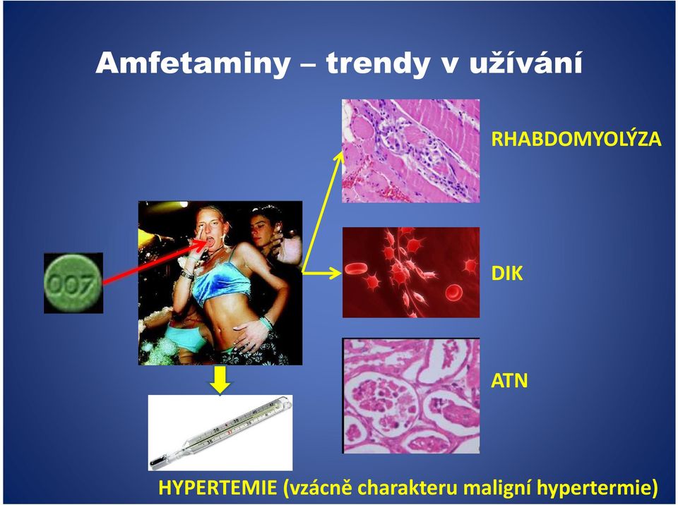 DIK ATN HYPERTEMIE