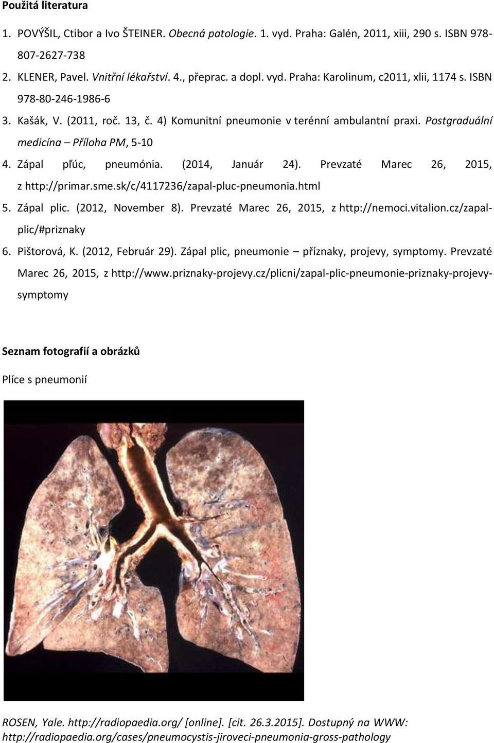 Prevzaté Marec 26, 2015, z http://primar.sme.sk/c/4117236/zapal-pluc-pneumonia.html 5. Zápal plic. (2012, November 8). Prevzaté Marec 26, 2015, z http://nemoci.vitalion.cz/zapalplic/#priznaky 6.