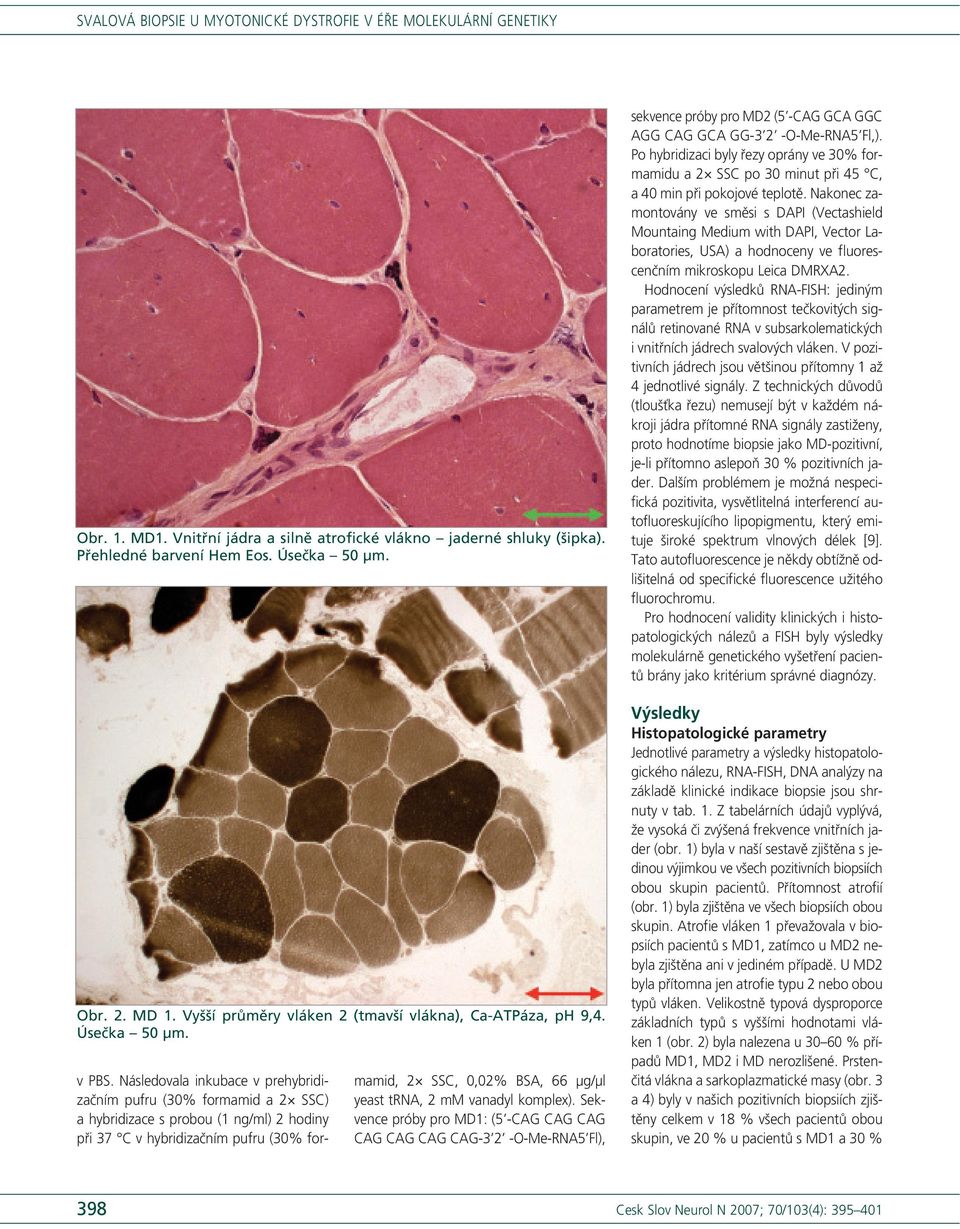 Následovala inkubace v prehybridizačním pufru (30% formamid a 2 SSC) a hybridizace s probou (1 ng/ml) 2 hodiny při 37 C v hybridizačním pufru (30% formamid, 2 SSC, 0,02% BSA, 66 μg/μl yeast trna, 2