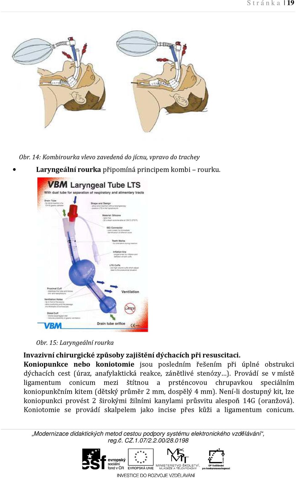 Provádí se v místě ligamentum conicum mezi štítnou a prsténcovou chrupavkou speciálním koniopunkčním kitem (dětský průměr 2 mm, dospělý 4 mm).