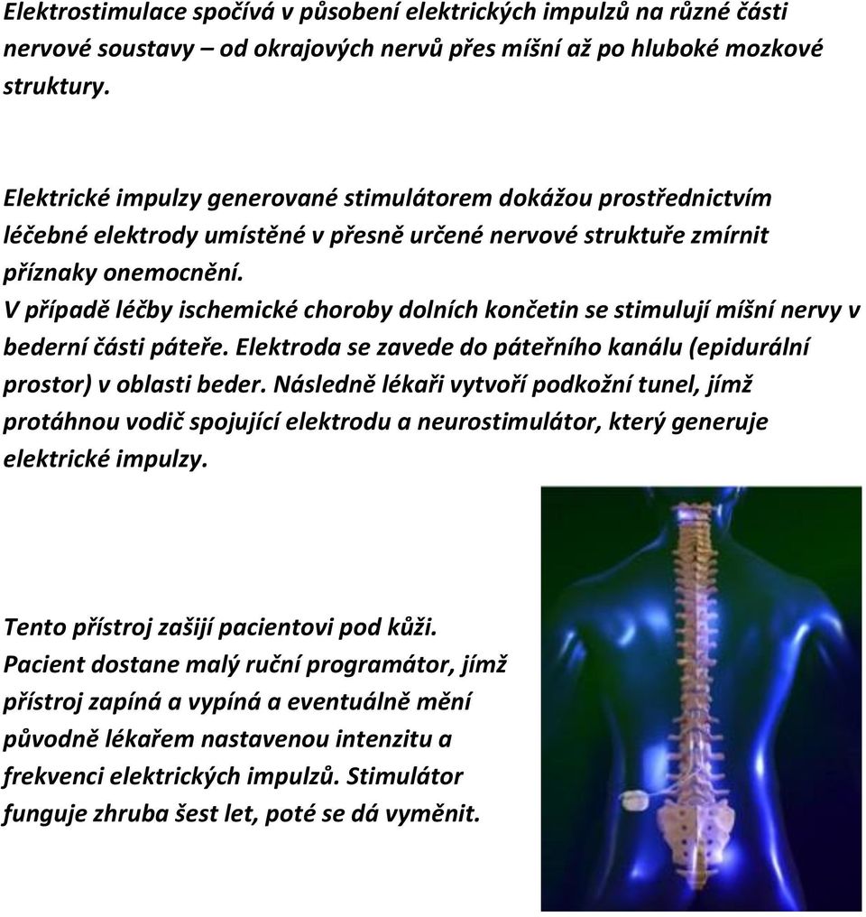V případě léčby ischemické choroby dolních končetin se stimulují míšní nervy v bederní části páteře. Elektroda se zavede do páteřního kanálu (epidurální prostor) v oblasti beder.