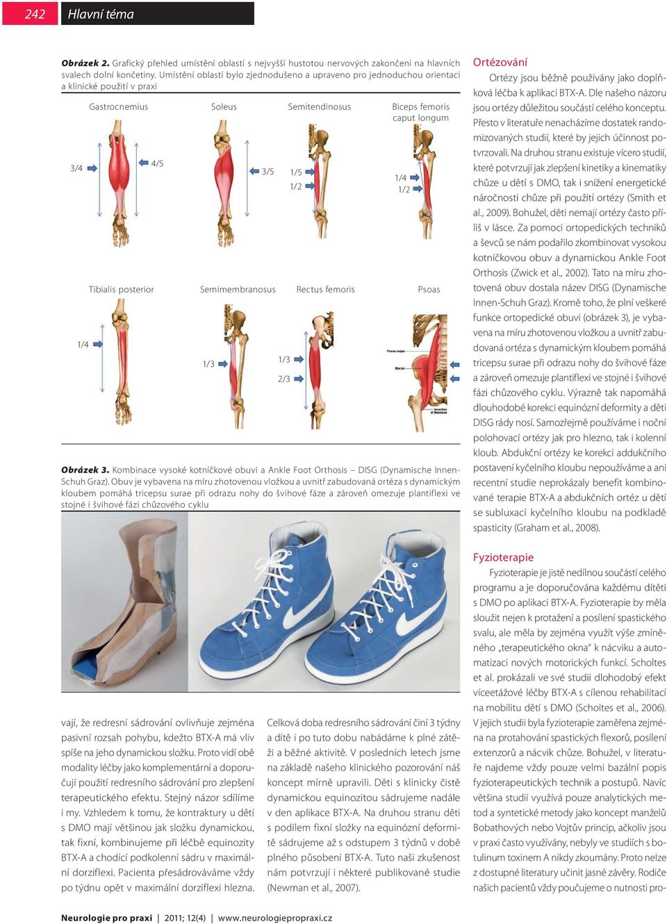 Semitendinosus Biceps femoris caput longum 3/5 1/5 1/4 1/2 1/2 Obrázek 3. Kombinace vysoké kotníčkové obuvi a Ankle Foot Orthosis DISG (Dynamische Innen- Schuh Graz).