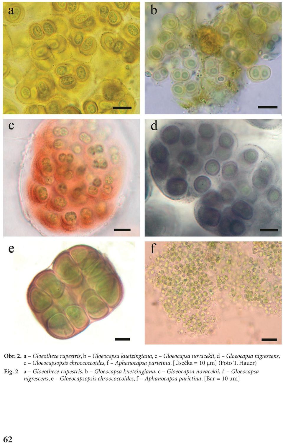 nigrescens, e Gloeocapsopsis chroococcoides, f Aphanocapsa parietina. [Úsečka = 10 µm] (Foto T.