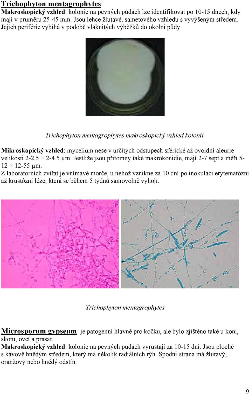 Mikroskopický vzhled: mycelium nese v určitých odstupech sférické až ovoidní aleurie velikosti 2-2.5 2-4.5 µm. Jestliže jsou přítomny také makrokonidie, mají 2-7 sept a měří 5-12 12-55 µm.