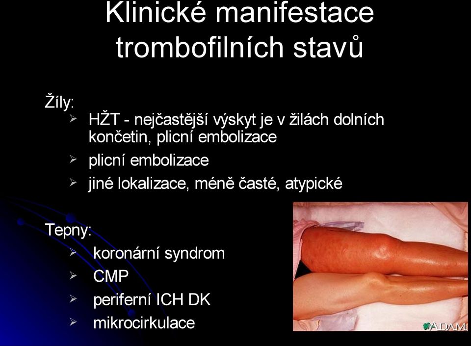 embolizace plicní embolizace jiné lokalizace, méně časté,