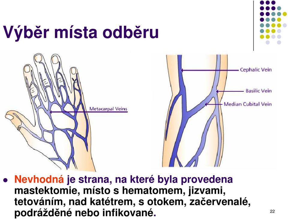 hematomem, jizvami, tetováním, nad katétrem,