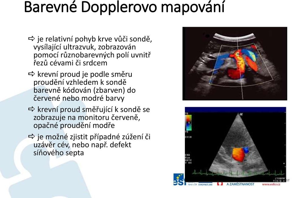 barevně kódován (zbarven) do červené nebo modré barvy krevní proud směřující k sondě se zobrazuje na