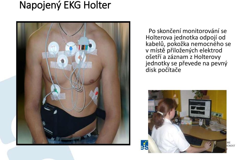 nemocného se v místě přiložených elektrod ošetří a